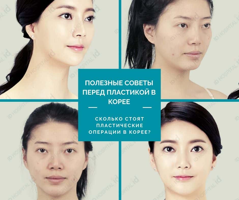 ПОЛЕЗНЫЕ СОВЕТЫ ПЕРЕД ПЛАСТИКОЙ В КОРЕЕ