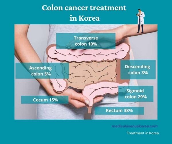 colon cancer treatment in Korea